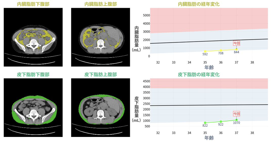 内臓脂肪の可視化