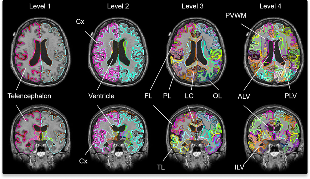 AI Analysis Atlas T1